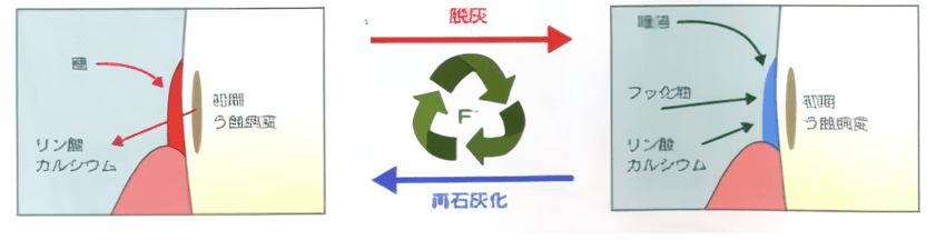 脱灰、再石灰化の図02