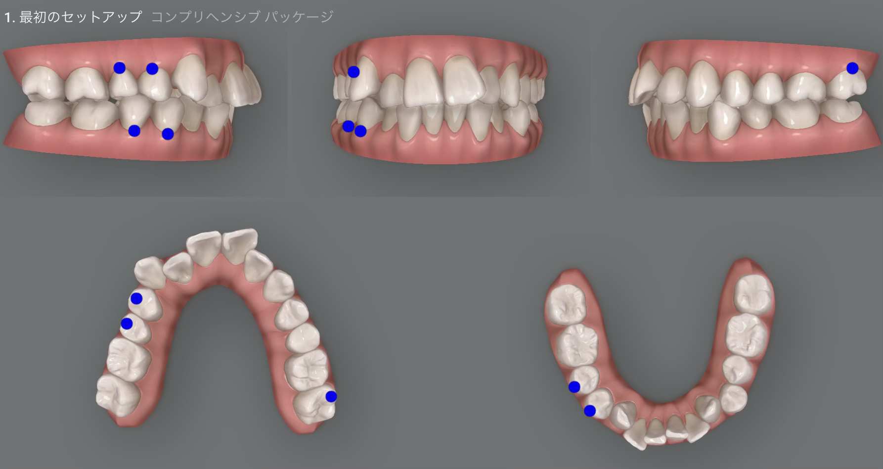 治療計画の作成