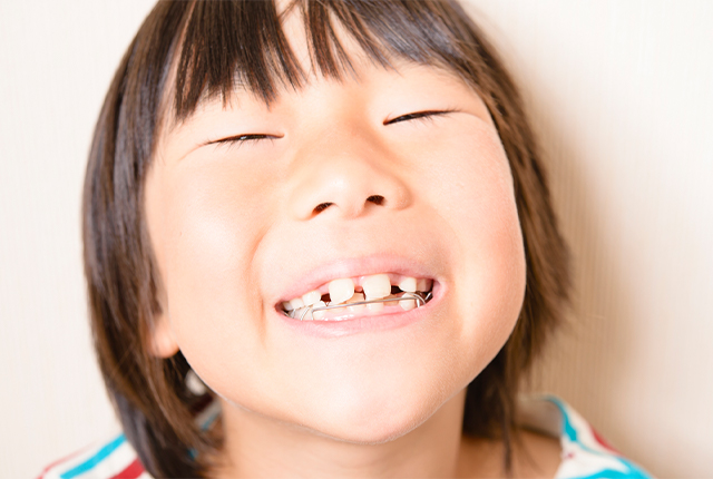小児矯正を受診される方によくあるお悩み・症状