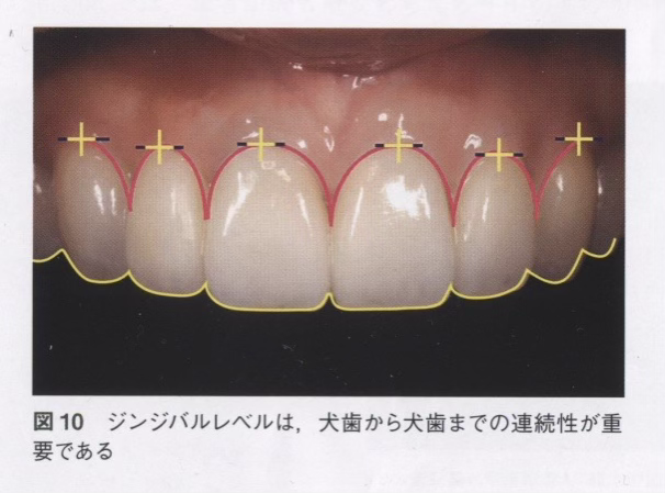 審美歯科治療を提案02
